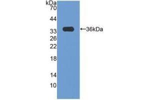 Detection of Recombinant CCND3, Human using Polyclonal Antibody to Cyclin D3 (CCND3) (Cyclin D3 anticorps  (AA 1-292))