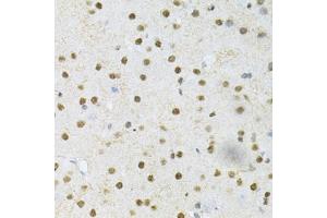 Immunohistochemistry of paraffin-embedded mouse brain using SNRPE Antibody (ABIN1876676) at dilution of 1:200 (40x lens). (SNRPE anticorps)