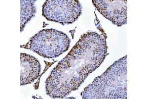 IHC analysis of MBNL1 using anti-MBNL1 antibody (ABIN7602608). (MBNL1 anticorps  (AA 89-388))