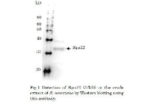 Western Blotting (WB) image for anti-Proteasome (Prosome, Macropain) 26S Subunit, Non-ATPase, 8 (PSMD8) antibody (ABIN2452112)