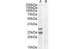 HEK293 overexpressing SOCS1 and probed with ABIN2560058 (mock transfection in lane B). (SOCS1 anticorps  (C-Term))