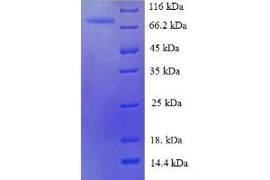 SDS-PAGE (SDS) image for Heat Shock 70kDa Protein 6 (HSP70B') (HSPA6) (AA 1-637), (partial) protein (His tag) (ABIN5711769)