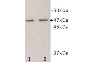 Western Blotting (WB) image for anti-Transmembrane Protein 200A (TMEM200A) antibody (ABIN1854992) (TMEM200A anticorps)