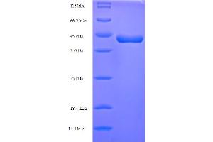 SDS-PAGE (SDS) image for p40 (p63 Delta) (AA 1-354), (full length) protein (His tag) (ABIN5714026) (p40 (p63 Delta) (AA 1-354), (full length) protein (His tag))