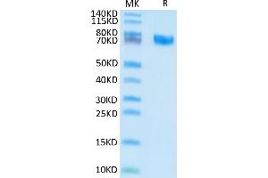 Human EPHA5 on Tris-Bis PAGE under reduced condition. (EPH Receptor A5 Protein (EPHA5) (AA 26-573) (His tag))