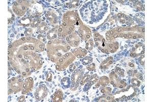 SSR1 antibody was used for immunohistochemistry at a concentration of 4-8 ug/ml to stain Epithelial cells of renal tubule (arrows) in Human Kidney.