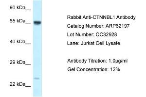 Western Blotting (WB) image for anti-Catenin, beta Like 1 (CTNNBL1) (C-Term) antibody (ABIN2789059) (CTNNBL1 anticorps  (C-Term))