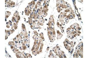 ITGB1BP2 antibody was used for immunohistochemistry at a concentration of 4-8 ug/ml to stain Skeletal muscle cells (arrows) in Human Muscle. (ITGB1BP2 anticorps)