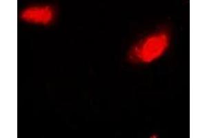 Immunofluorescent analysis of SIRT7 staining in Hela cells. (SIRT7 anticorps)