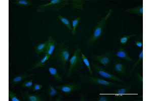 Immunofluorescence of purified MaxPab antibody to SETBP1 on HeLa cell. (SETBP1 anticorps  (AA 1-242))