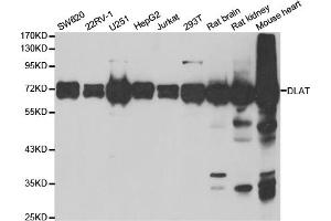 Western blot analysis of extracts of various cell lines, using DLAT antibody. (DLAT anticorps)