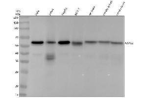 Western blot analysis of USP22 using anti-USP22 antibody (ABIN7606664).