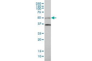 TGFB1I1 monoclonal antibody (M01), clone 4B2-D8 Western Blot analysis of TGFB1I1 expression in Hela .