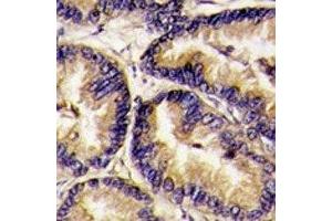 anti-VEGFB (VEGF2) (AA 110-139) antibody