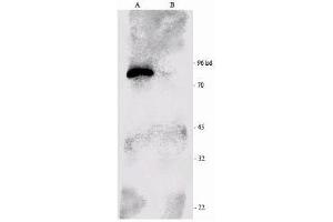Western-blot analysis of p90 RSK1 immunoprecipitated from the mouse brain extract (B) and using RSK1-HRP as a probe. (RPS6KA1 anticorps  (C-Term))