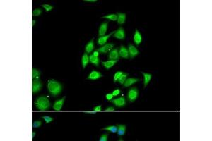 Immunofluorescence analysis of HeLa cells using NFS1 Polyclonal Antibody (NFS1 anticorps)