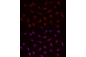 Immunofluorescence analysis of A-549 cells using Smad7 Rabbit pAb (ABIN6133913, ABIN6148093, ABIN6148095 and ABIN6215945) at dilution of 1:50 (40x lens). (SMAD7 anticorps  (AA 1-100))