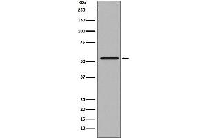 Western blot analysis of Smad2 expression in Jurkat cell lysate.