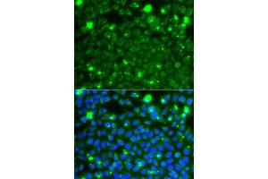 Immunofluorescence analysis of A549 cells using HSPE1 antibody. (HSPE1 anticorps  (AA 1-102))