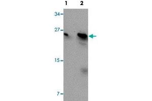 Western blot analysis of MCF-7 cells with BCAS2 polyclonal antibody  at (Lane 1) 0.