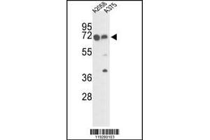 Western blot analysis of FKBP10 Antibody in A2058 and A375 cell line lysates (35ug/lane) (FKBP10 anticorps  (C-Term))