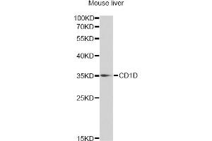 Western blot analysis of extracts of mouse liver, using CD1D antibody (ABIN6292676) at 1:1000 dilution. (CD1d anticorps)