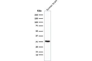 Western Blot Analysis of human brain tissue lysate using Pgp9.