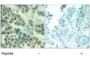 Image no. 3 for anti-Mdm2, p53 E3 Ubiquitin Protein Ligase Homolog (Mouse) (MDM2) (Ser166) antibody (ABIN319418) (MDM2 anticorps  (Ser166))
