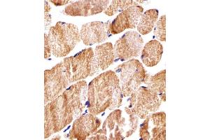 Immunohistochemical analysis of paraffin-embedded H. (COX6A2 anticorps  (AA 37-66))