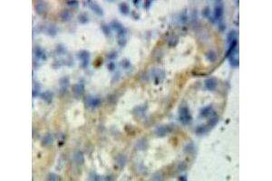 Used in DAB staining on fromalin fixed paraffin-embedded Kidney tissue (BCL2L1 anticorps  (AA 2-212))