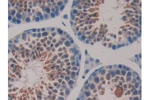 Detection of HSP40 in Mouse Testis Tissue using Polyclonal Antibody to Heat Shock Protein 40 (HSP40)