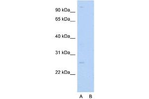 Host:  Rabbit  Target Name:  RAB14  Sample Type:  HepG2  Lane A:  Primary Antibody  Lane B:  Primary Antibody + Blocking Peptide  Primary Antibody Concentration:  2.