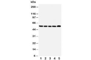 Western blot testing of NK1R antibody and Lane 1:  A549 (TACR1 anticorps  (Middle Region))