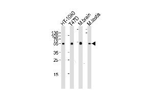 Western blot analysis of lysates from HT-1080, T47D cell line, mouse brain and testis tissue lysate (from left to right), using TUBA1C Antibody at 1:1000 at each lane.