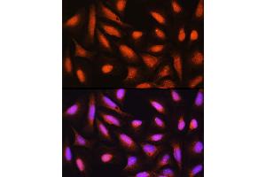 Immunofluorescence analysis of U-2 OS cells using GMFB Rabbit pAb (ABIN6131732, ABIN6141181, ABIN6141182 and ABIN6224741) at dilution of 1:100 (40x lens).