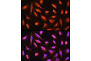 Immunofluorescence analysis of U-2 OS cells using GMFB Rabbit pAb (ABIN6131732, ABIN6141181, ABIN6141182 and ABIN6224741) at dilution of 1:100 (40x lens). (GMFB anticorps  (AA 1-140))