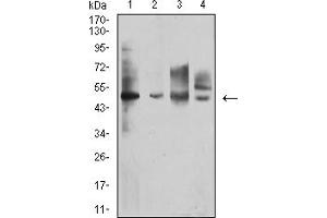 Western blot analysis using CD213A1 mouse mAb against Raji (1), A431 (2), HT-29 (3), and A549 (4) cell lysate.