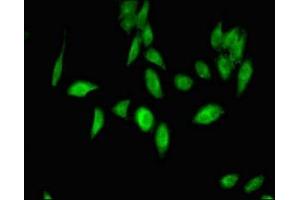 Immunofluorescent analysis of Hela cells using ABIN7174571 at dilution of 1:100 and Alexa Fluor 488-congugated AffiniPure Goat Anti-Rabbit IgG(H+L)