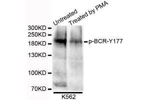 Western blot analysis of extracts of K562 cells, using Phospho-BCR-Y177 antibody.