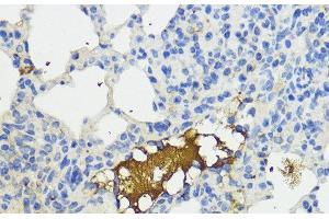 Immunohistochemistry of paraffin-embedded Mouse lung using Complement Factor B Polyclonal Antibody at dilution of 1:200 (40x lens).