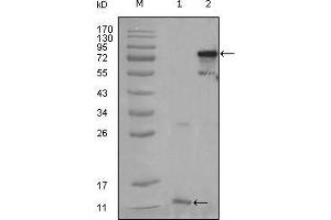 Western Blot showing PPARG antibody used against truncated PPARG-His recombinant protein (1) and full-length PPARG (aa1-477) transfected CHO-K1 cell lysate (2). (PPARG anticorps  (AA 170-270))