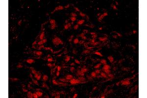 Immunofluorescence (IF) image for anti-Breast Cancer 1 (BRCA1) (AA 700-750) antibody (ABIN7448934) (BRCA1 anticorps  (AA 700-750))