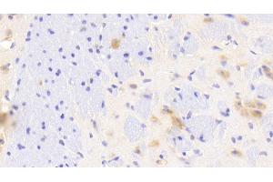 Detection of GAB2 in Mouse Cerebrum Tissue using Polyclonal Antibody to GRB2 Associated Binding Protein 2 (GAB2)