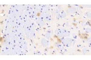 Detection of GAB2 in Mouse Cerebrum Tissue using Polyclonal Antibody to GRB2 Associated Binding Protein 2 (GAB2) (GAB2 anticorps  (AA 357-607))
