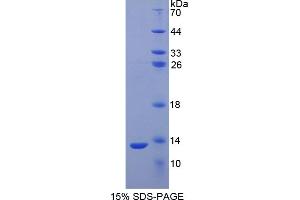 SDS-PAGE of Protein Standard from the Kit (Highly purified E. (S100A2 Kit ELISA)