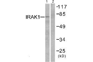Western blot analysis of extracts from HeLa cells, using IRAK1 (Ab-387) antibody. (IRAK1 anticorps  (Thr387))