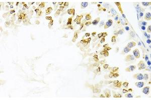 Immunohistochemistry of paraffin-embedded Mouse testis using GEMIN2 Polyclonal Antibody at dilution of 1:100 (40x lens). (SIP1 anticorps)