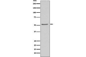 Western blot analysis of Angiotensinogen expression in 293T cell lysate.