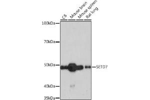 Western blot analysis of extracts of various cell lines, using SETD7 Rabbit mAb (ABIN7270261) at 1:1000 dilution. (SETD7 anticorps)