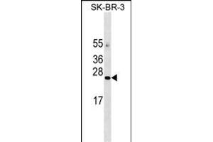 AGTR Antibody (C-term) 18437b western blot analysis in SK-BR-3 cell line lysates (35 μg/lane). (AGTRAP anticorps  (C-Term))